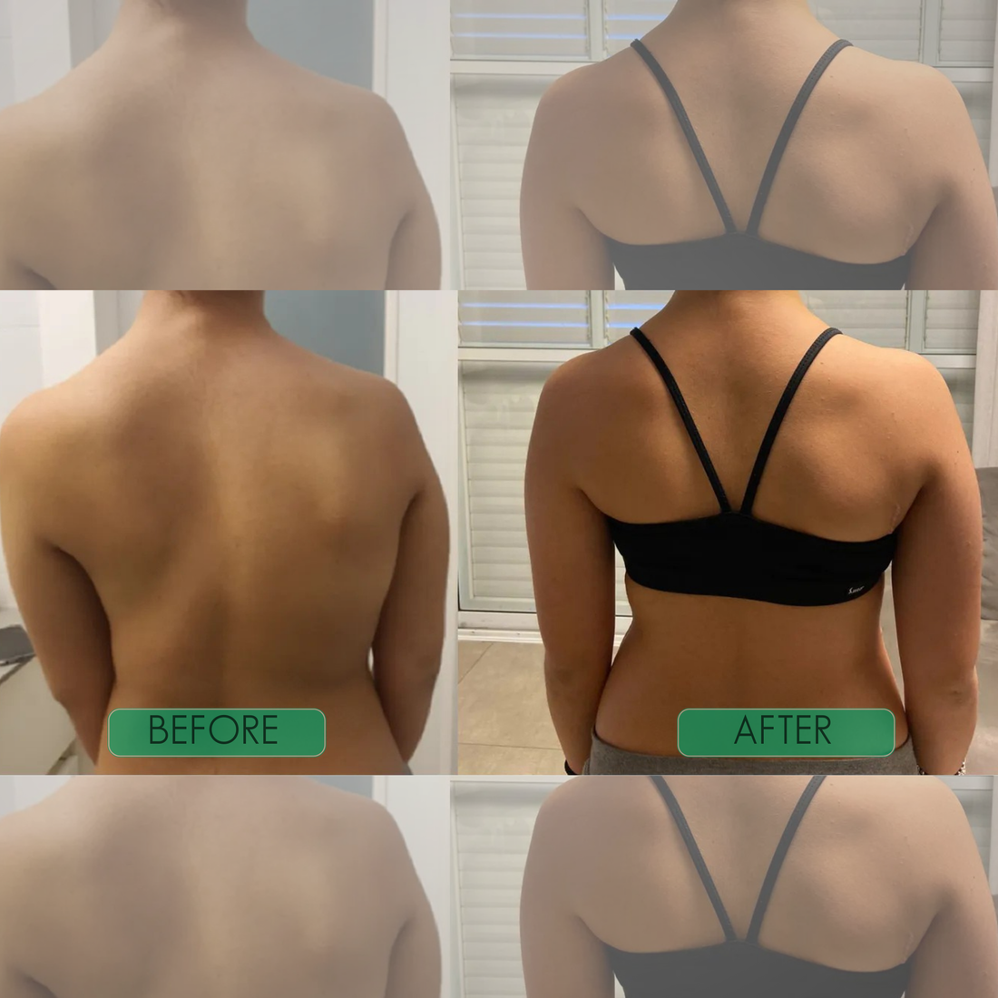 Posture Fix Corrector in use