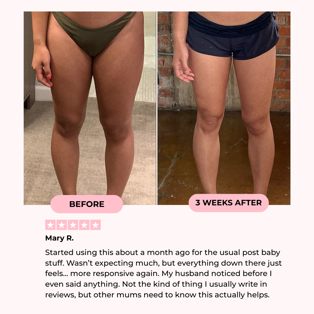 ReWired Pelvic Confidence Trainer detail