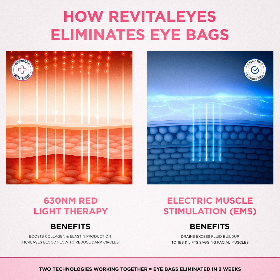 LumaEye eliminates eye bags