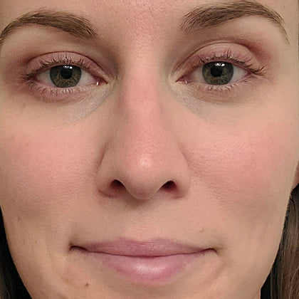 ReWired Glow Wand after results - Rachel day 21 more even tone