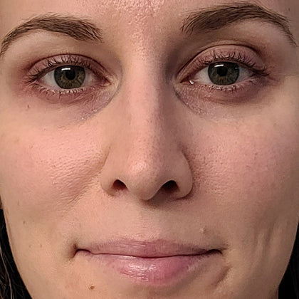 ReWired Glow Wand before and after results - Rachel day 1 vs day 21